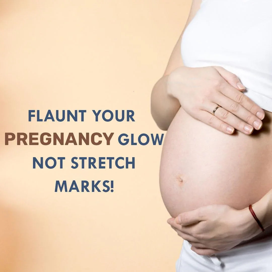 Natural Stretch Mark Cream for Women & Men - 50gm - Veda Harvest