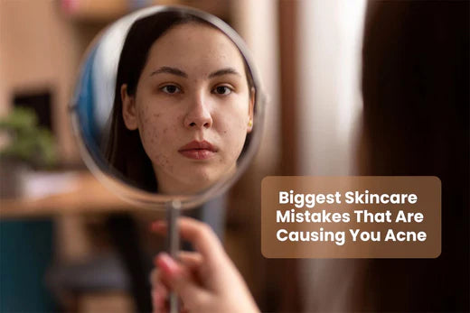 Biggest Skincare Blunders That Are Causing Acne