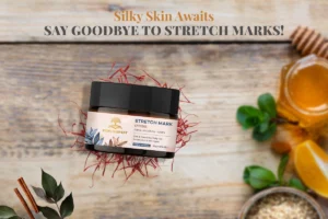 stretch mark cream, how stretch can be removed? how to remove stretch marks from skin or secret parts? best ayurvedic stretch mark cream